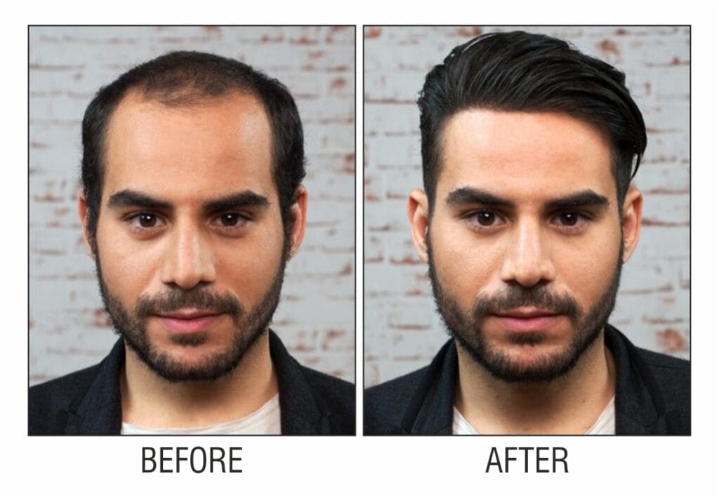 hair smoothening in bhopal